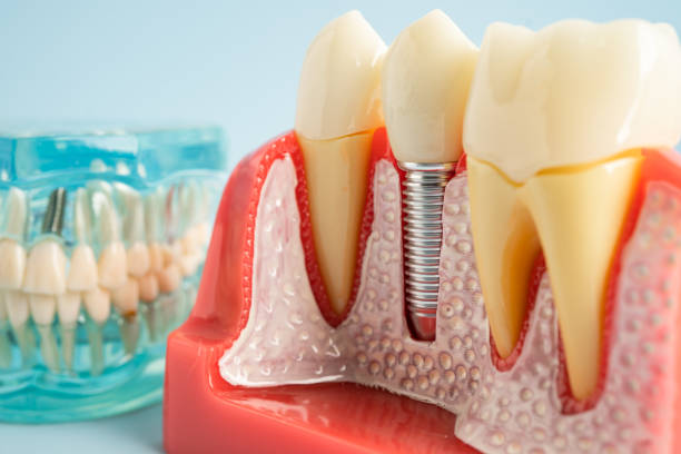 Reliable West Liberty, WV  Dental Services Solutions